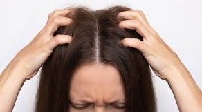 Natural Treatment for Fungal Infections, Itchy Scalp, and Dryness